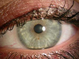 iridologia-corsi-online-consulenza-milano